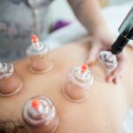 Experience the Benefits of Cupping Therapy for Pain Relief and Relaxation